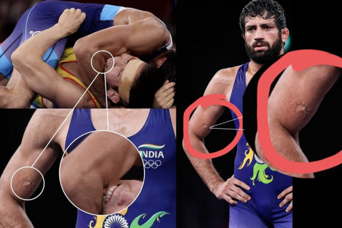 Tokyo Olympics: Silver-medalist Ravi Dahiya reveals the truth behind Kazakh wrestler’s bite-tale, ‘He hugged me and said sorry brother’