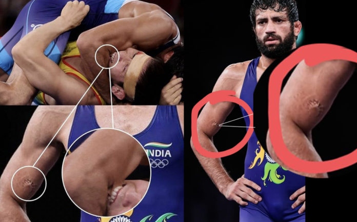 India at Tokyo Olympics: Good news, Wrestler Ravi Dahiya fit for the finals ahead of finals despite bite by Sanayev